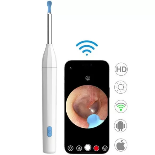 Elektromos fültisztító készlet, otoszkóp, HD mini kamerával, Wifi-s, LED világítással, Wooze Visual Ear Cleaner, fehér